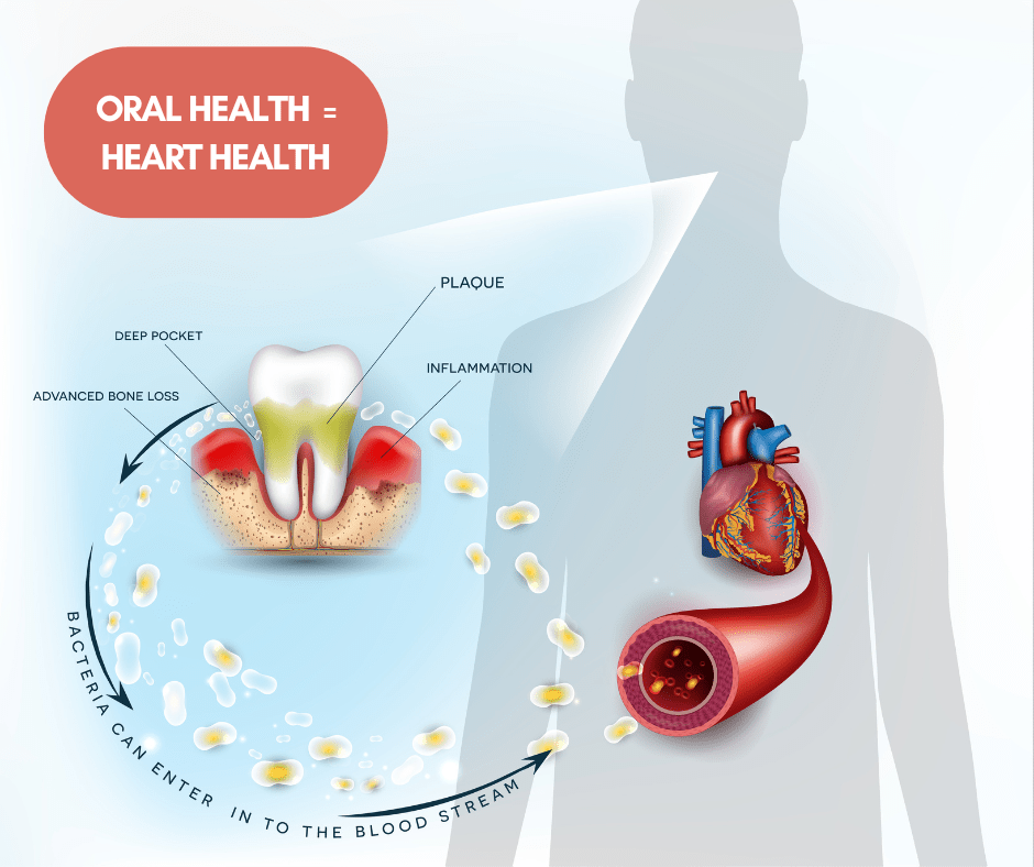 Connecting Heart Health and Oral Health