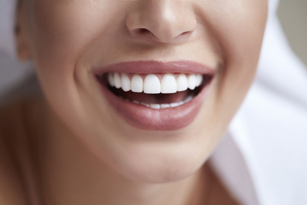 The Dental Veneer Process: What To Expect