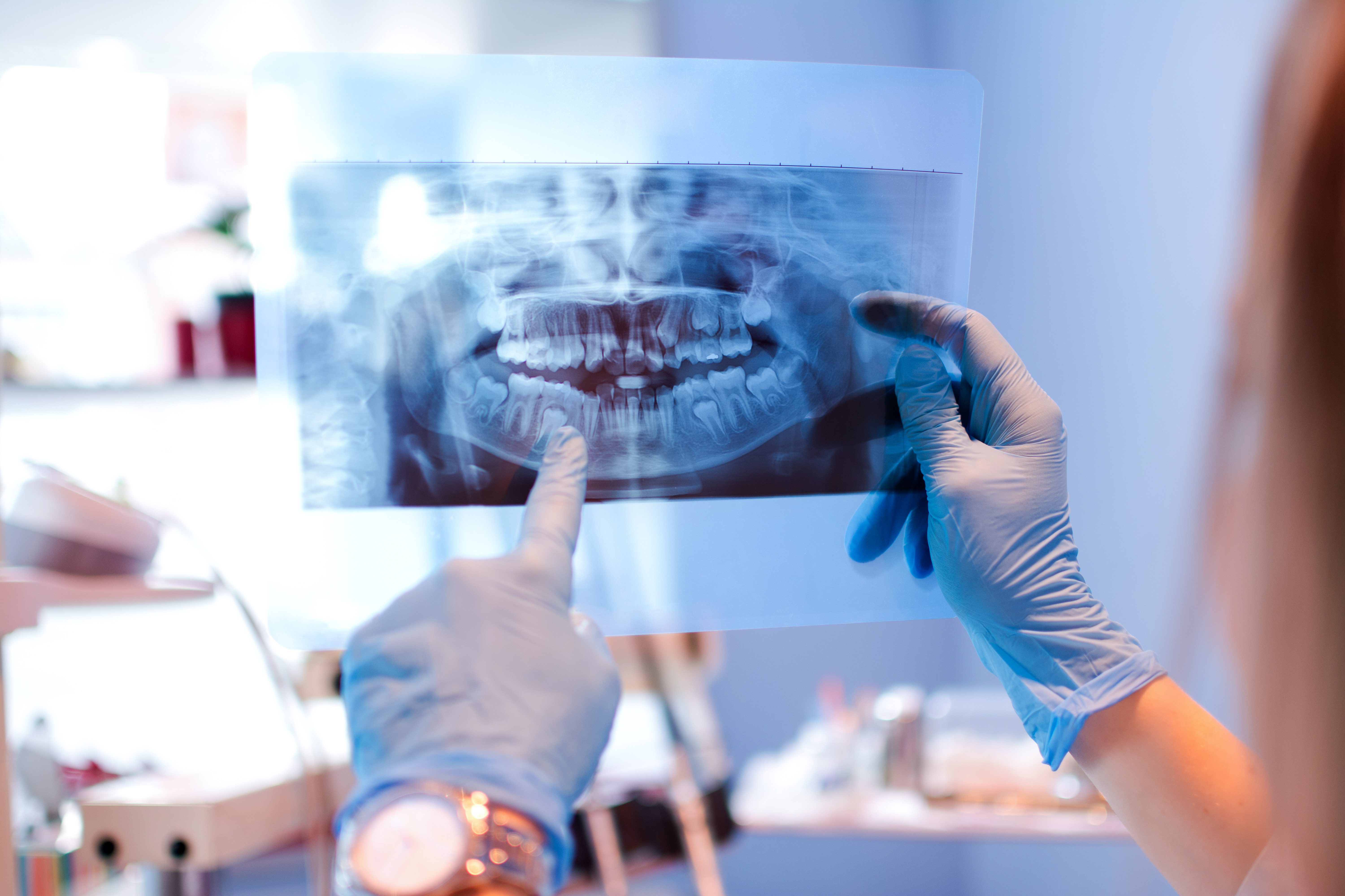 $99 exam and xrays